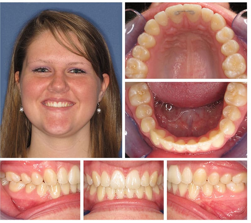 Dentist in Johnson City | Cannon Family Dental | Elizabeth F. Cannon DDS